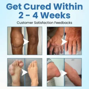 EnduraHeal Magnesium Pain Relief Cream