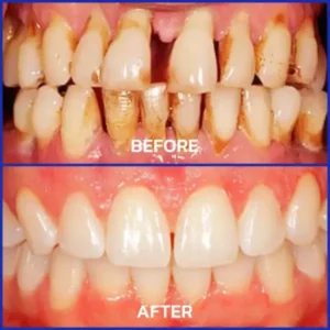 VioGloss Bienengift-Zahntherapie Oral Power