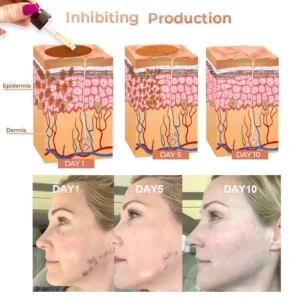 Fast Dark Spot Remover - Image 15
