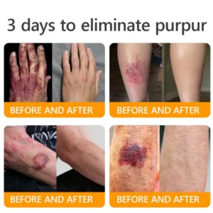 𝐓𝐚𝐥𝐥𝐨𝐰 𝐁𝐞𝐞 𝐕𝐞𝐧𝐨𝐦 𝐒𝐤𝐢𝐧 𝐑𝐞𝐬𝐭𝐨𝐫𝐚𝐭𝐢𝐨𝐧 𝐂𝐫𝐞𝐚𝐦 - Image 2