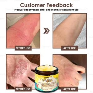 𝐓𝐚𝐥𝐥𝐨𝐰 𝐁𝐞𝐞 𝐕𝐞𝐧𝐨𝐦 𝐒𝐤𝐢𝐧 𝐑𝐞𝐬𝐭𝐨𝐫𝐚𝐭𝐢𝐨𝐧 𝐂𝐫𝐞𝐚𝐦 - Image 8