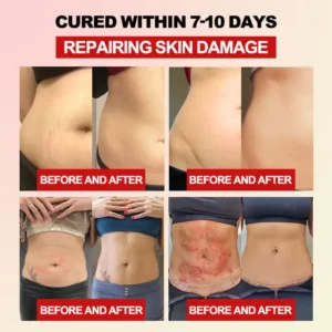 𝐅𝐢𝐛𝐞𝐫 𝐚𝐧𝐝 𝐖𝐨𝐫𝐦𝐰𝐨𝐨𝐝 𝐁𝐨𝐝𝐲 𝐒𝐡𝐚𝐩𝐢𝐧𝐠 𝐖𝐚𝐢𝐬𝐭 𝐏𝐫𝐨𝐭𝐞𝐜𝐭𝐨𝐫 - Image 5