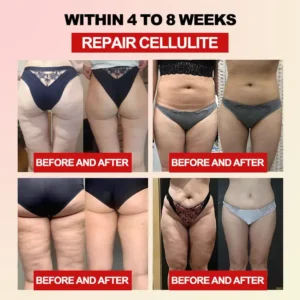 𝐅𝐢𝐛𝐞𝐫 𝐚𝐧𝐝 𝐖𝐨𝐫𝐦𝐰𝐨𝐨𝐝 𝐁𝐨𝐝𝐲 𝐒𝐡𝐚𝐩𝐢𝐧𝐠 𝐖𝐚𝐢𝐬𝐭 𝐏𝐫𝐨𝐭𝐞𝐜𝐭𝐨𝐫 - Image 6