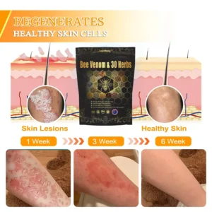 𝐁𝐞𝐞 𝐕𝐞𝐧𝐨𝐦 & 𝟑𝟎-𝐇𝐞𝐫𝐛 𝐃𝐞𝐭𝐨𝐱 𝐅𝐨𝐨𝐭 𝐒𝐨𝐚𝐤 𝐁𝐞𝐚𝐝𝐬 𝐟𝐨𝐫 𝐁𝐨𝐝𝐲 𝐒𝐜𝐮𝐥𝐩𝐭𝐢𝐧𝐠 - Image 11
