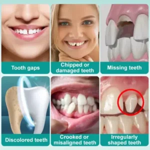 𝗜𝗻𝘀𝘁𝗮𝗻𝘁 𝗦𝘁𝗶𝗰𝗸-𝗼𝗻 𝗗𝗲𝗻𝘁𝗮𝗹 𝗩𝗲𝗻𝗲𝗲𝗿𝘀 - Image 3