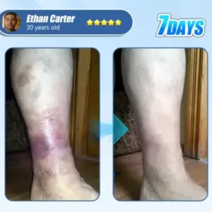 Diabetic Skin Revolution - Image 2
