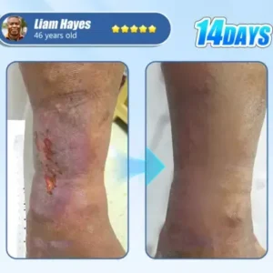 Diabetic Skin Revolution – 6-IN-1 Clinical Solution Black Fridey - Image 3