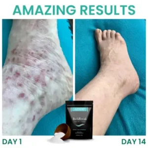 ItchBreak Sea Salt Soak - Image 6