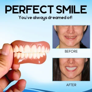 SnapOn Silicone Veneers - Image 4
