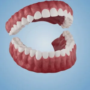 Advanced Customized Full Denture Set