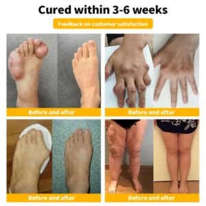 Bee Venom & Turmeric Arthritis Therapy Cream - Image 9