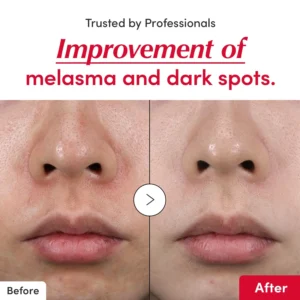 LOVILDS ™Vitamin illuminating Serum - Image 5