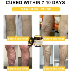 ArthroEase Bee Venom Arthritis Therapy Cream - Image 6