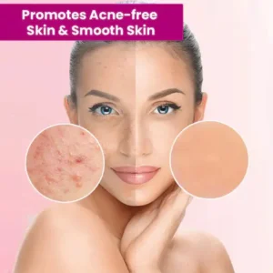 Tags & Moles Remover - Image 7