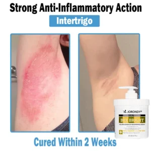 Bee Bright Multi-Symptom Skin Treatment Cream - Image 7