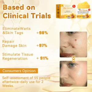 Bee Venom Wart & Moles Removal Cream - Image 8