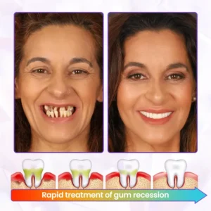 BeeRenew Advanced Gum Healing Toothpaste - Image 2