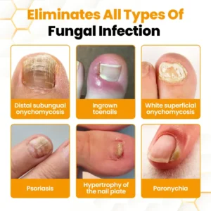 BeeVenom Anti-Fungal Nail Renewal Oil - Image 3