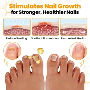 BeeVenom Anti-Fungal Nail Renewal Oil - Image 5