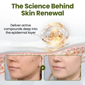 MagneErase Renewal Cream - Image 4