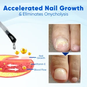 OnyxoGuard Nail Growth and Repair Serum - Image 3