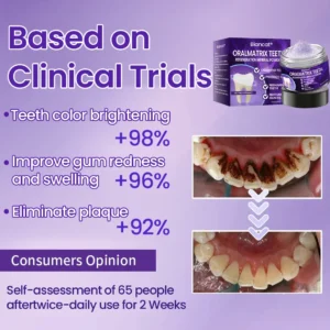 OralMatrix Teeth Regeneration Mineral Powder - Image 2