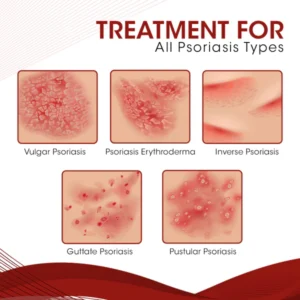 DermaCure Psoriasis Treatment Spray - Image 6