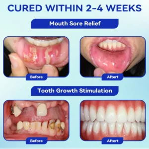 Focus Smile Bee Venom Treatment Oral Powder - Image 6