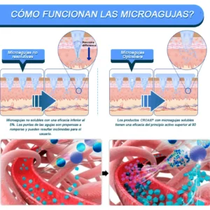 Nano-Parche de Microagujas - Image 6