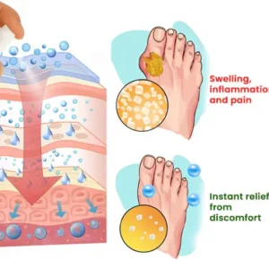 GoutEase Relief Spray - Image 8