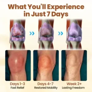 Premium Curcumin Pain Relief Gel - Image 6