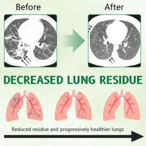 Herbal Antibacterial Lung Cleansing Nasal Spray - Image 4