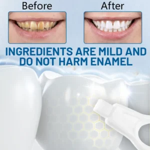 Highly effective tooth stain cleaner - Image 3