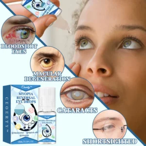 Myopia Reversal Eye Drops - Image 2
