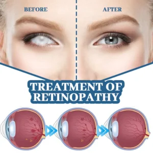 Myopia Reversal Eye Drops - Image 4