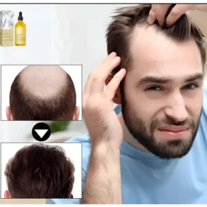 Rosemary Hair Growth Essence - Image 9