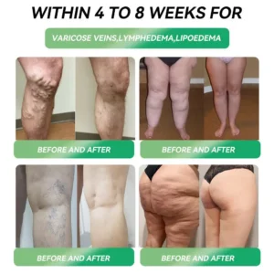𝐓𝐢𝐫𝐳𝐞𝐩𝐚𝐭𝐢𝐝𝐞 𝐒𝐢𝐱-𝐢𝐧-𝐎𝐧𝐞 𝗦𝗹𝗶𝗺 & 𝑯𝒆𝒂𝒍𝒕𝒉 𝑶𝒓𝒂𝒍 𝑺𝒐𝒍𝒖𝒕𝒊𝒐𝒏 - Image 4