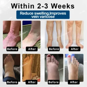 Magnetic EdemaCare Insoles - Image 3