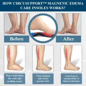 Magnetic EdemaCare Insoles - Image 7