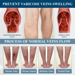 Magnetic EdemaCare Insoles - Image 8