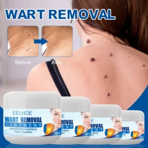 PRO Petechiae Removal Cream - Image 3