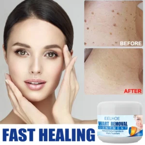 Petechiae Removal Cream - Image 4