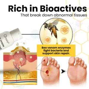 Bee Venom Diabetic Foot Ulcer Spray - Image 5
