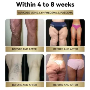Cyclic Peptide Thermo Slim Cream - Image 3
