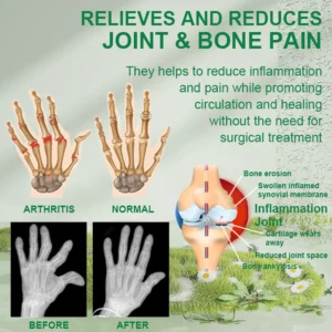 Bee Venom Joint and Bone Therapy Advanced Cream - Image 2