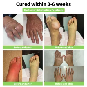 Bee Venom Joint and Bone Therapy Advanced Cream - Image 3