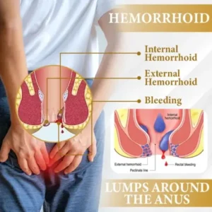 Apis Venom Hemorrhoid Cooling Spray - Image 6