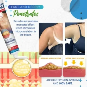 BumpClear Lipoma Removal Cream - Image 3
