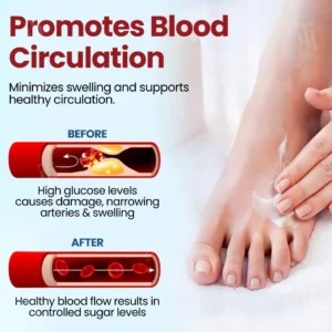 Diabetic Foot Ulcer Repair Cream - Image 4