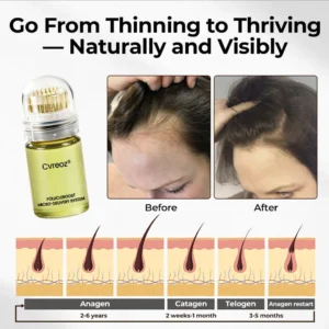FollicleBoost Micro-Delivery System Advanced Scalp Renewal Kit - Image 4